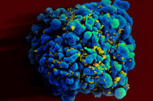 New Advances in HIV Research
