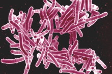 WHO targets elimination of TB in over 30 countries