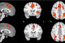 Playing an Instrument Is a Great Workout For Your Brain