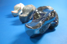 CSIRO produces 3D heel in world first surgery